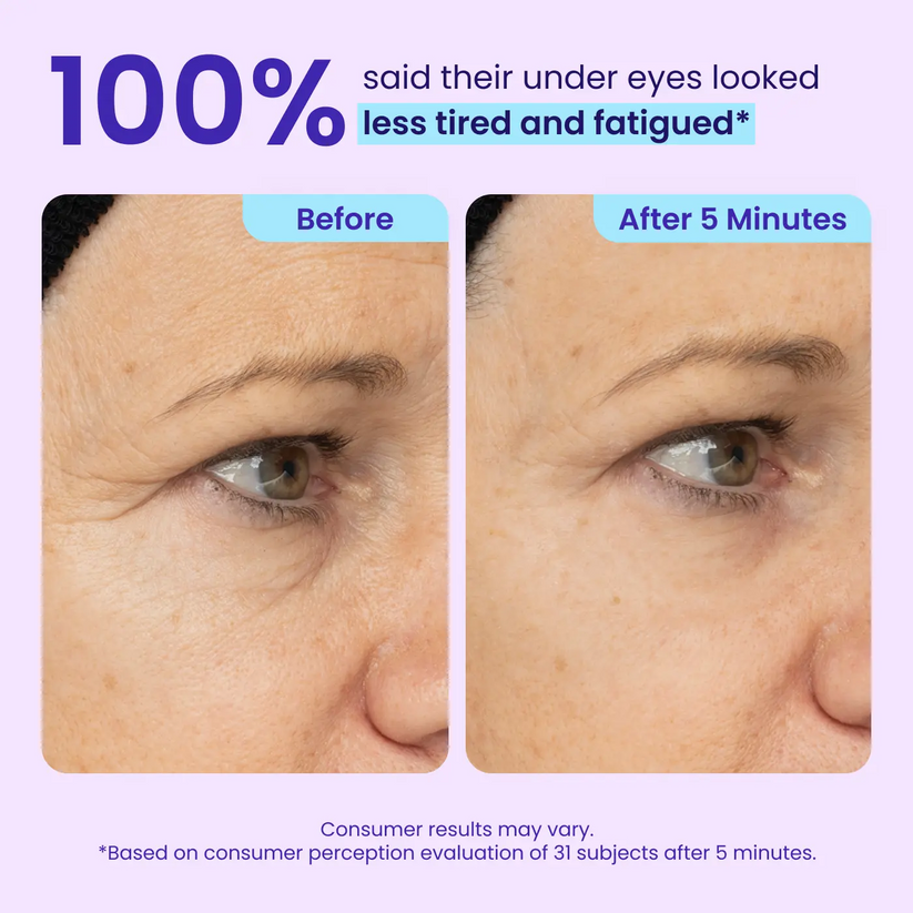 NEW🔥! Instant Lift Eye Gel — Reduce the Look of Eye Bags in Minutes