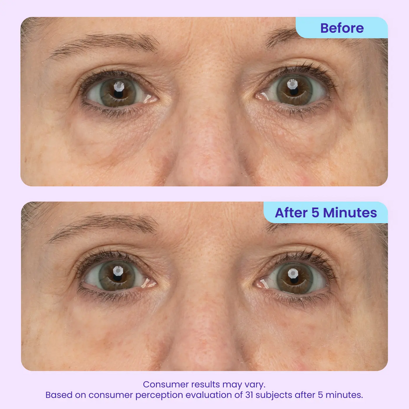 NEW🔥! Instant Lift Eye Gel — Reduce the Look of Eye Bags in Minutes