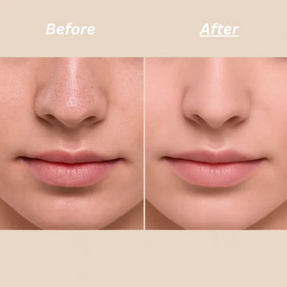 Dr Melaxin™ Peel Shot Ampoule