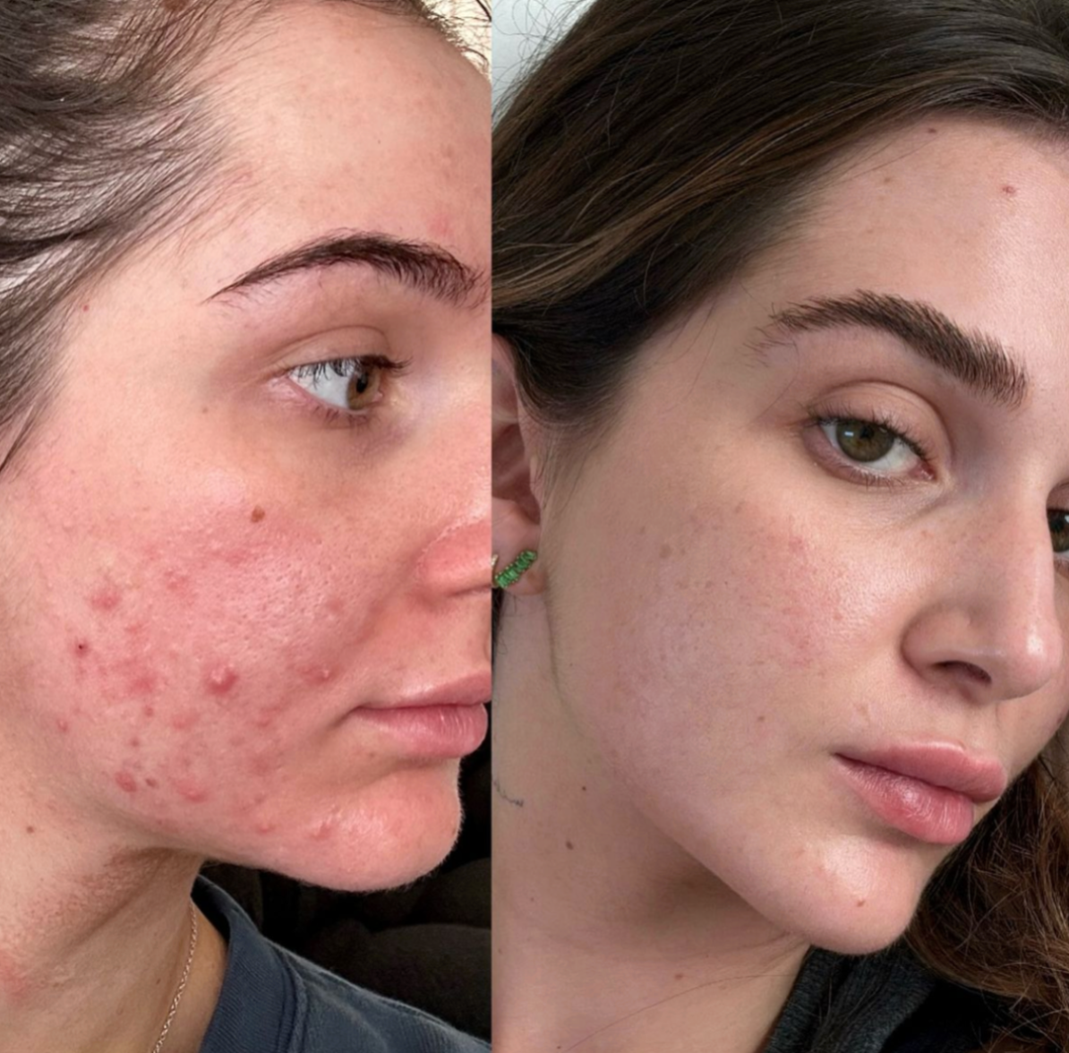 Before and after result
