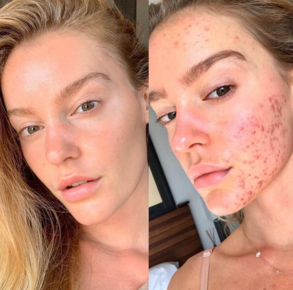 Before and after result