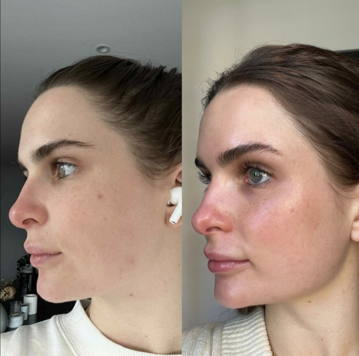 Before and after result