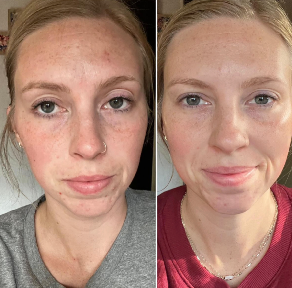 Before and after result