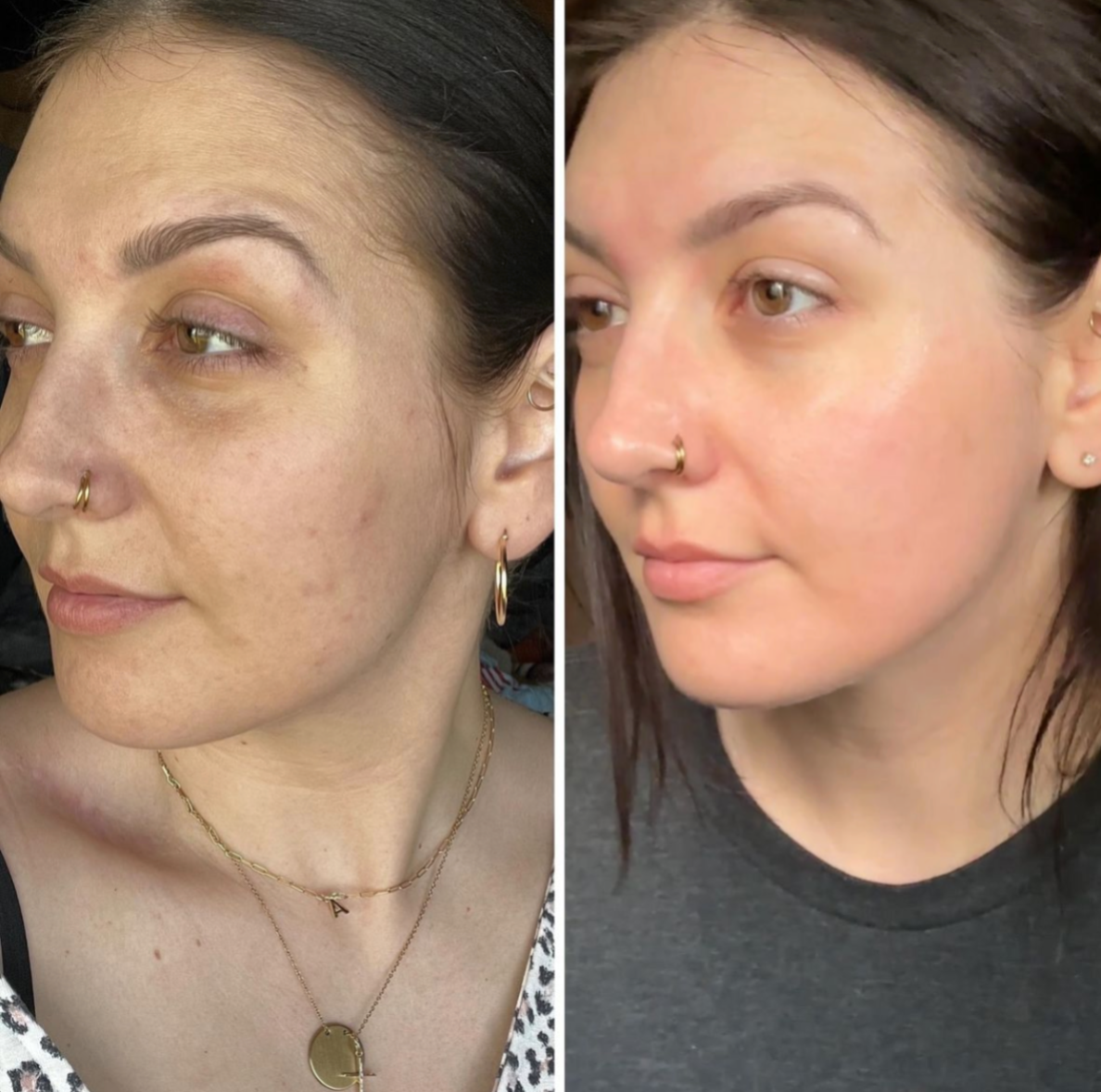 Before and after result