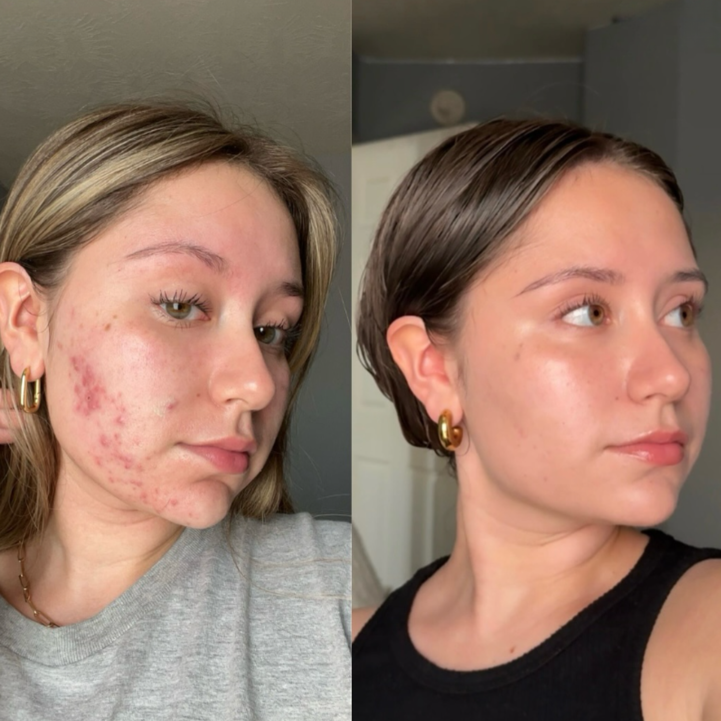 Medicube Glass Glow Skincare Set | 8-Step Hydrating & Radiance Routine
